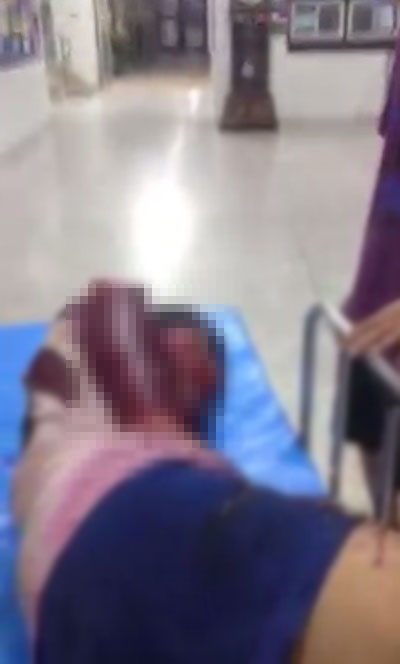 นางฟ้าตัวจริง ! สาวประเภทสองช่วยหนุ่มถูกฟันเลือดอาบส่งโรงพยาบาล นางฟ้าตัวจริง ! สาวประเภทสองช่วยหนุ่มถูกฟันเลือดอาบส่งโรงพยาบาล