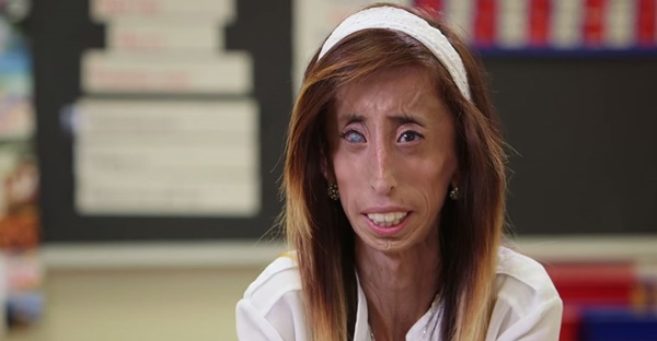 ลิซซี่ วีลาสเควซ ลิซซี่ วีลาสเควซ