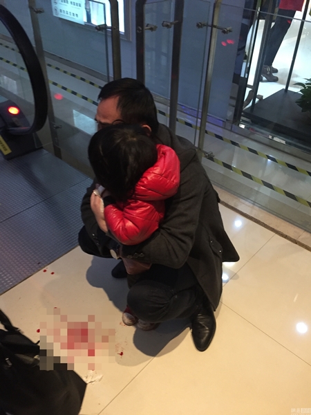 เด็ก 2 ขวบตกบันไดเลื่อน เด็ก 2 ขวบตกบันไดเลื่อน