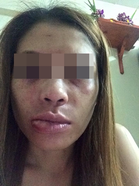 ทหารตบผู้หญิง ทหารตบผู้หญิง