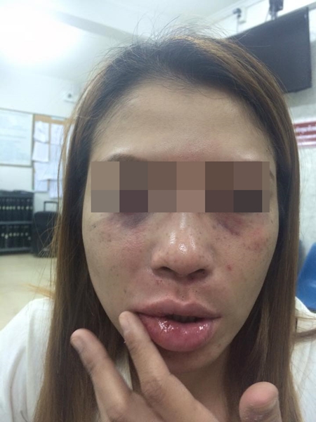 ทหารตบผู้หญิง ทหารตบผู้หญิง