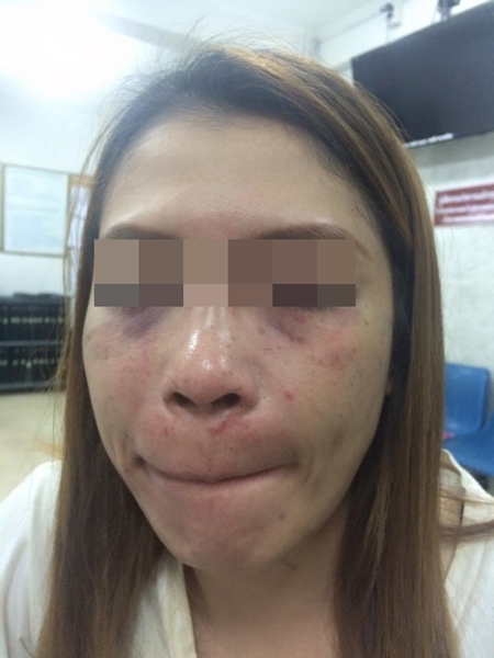 ทหารตบผู้หญิง ทหารตบผู้หญิง