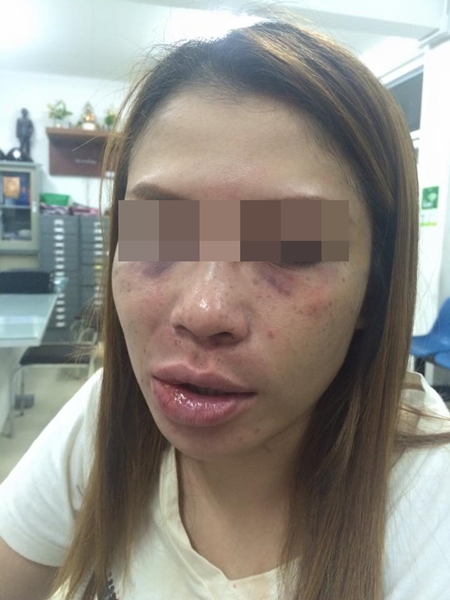 ทหารตบผู้หญิง ทหารตบผู้หญิง