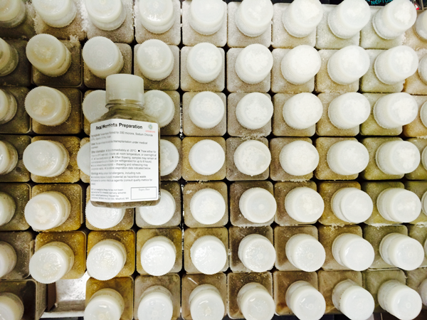 บริจาคอุจจาระ บริจาคอุจจาระ