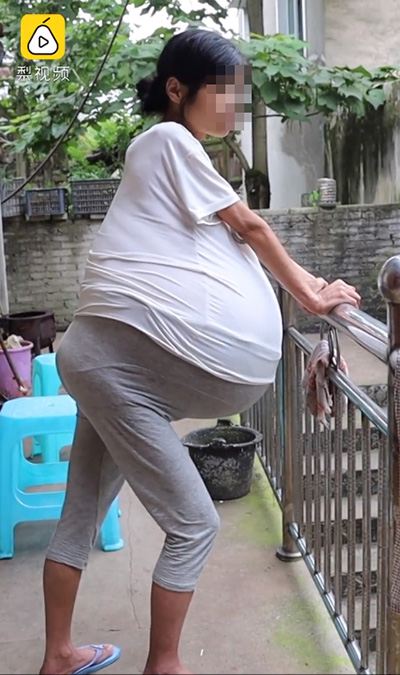 ภาพข่าว แม่สุดทรมาน ภาพข่าว แม่สุดทรมาน