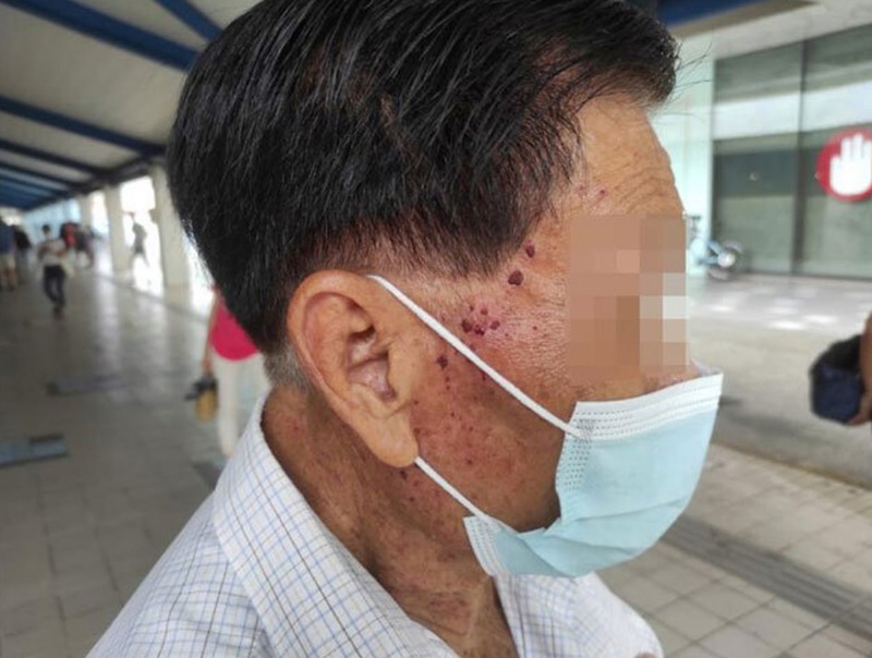 ตาวัย 87 ตาวัย 87