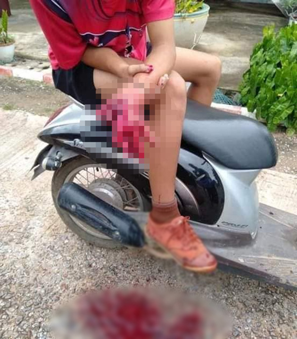 เด็ก 12 เล่นประทัด เด็ก 12 เล่นประทัด