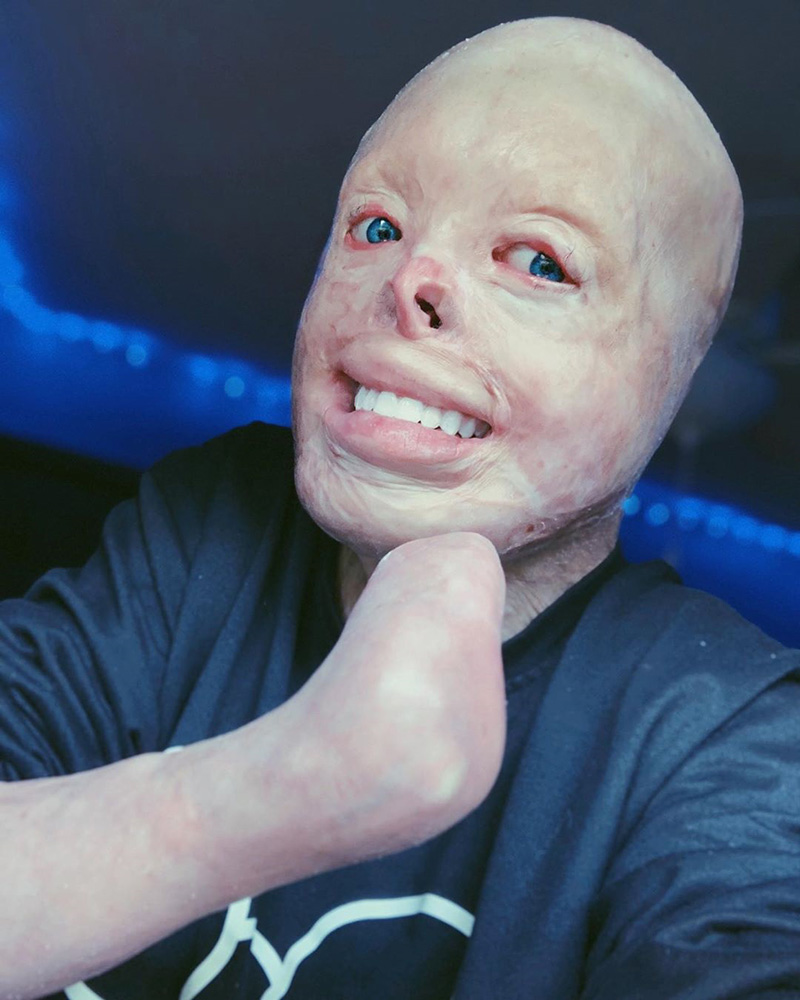 เหยื่อถูกไฟคลอก คอสเพลย์ เหยื่อถูกไฟคลอก คอสเพลย์