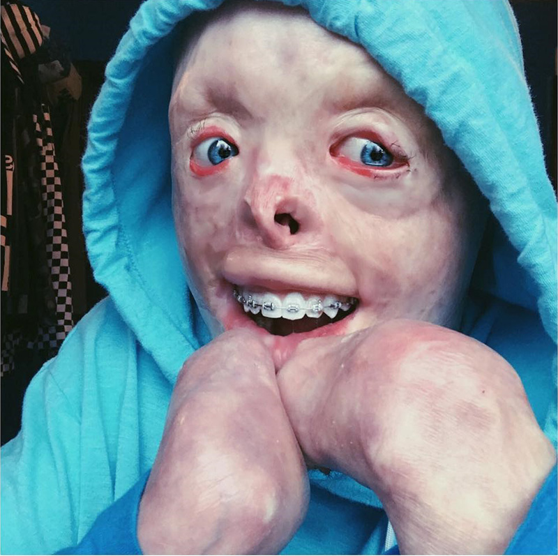 เหยื่อถูกไฟคลอก คอสเพลย์ เหยื่อถูกไฟคลอก คอสเพลย์