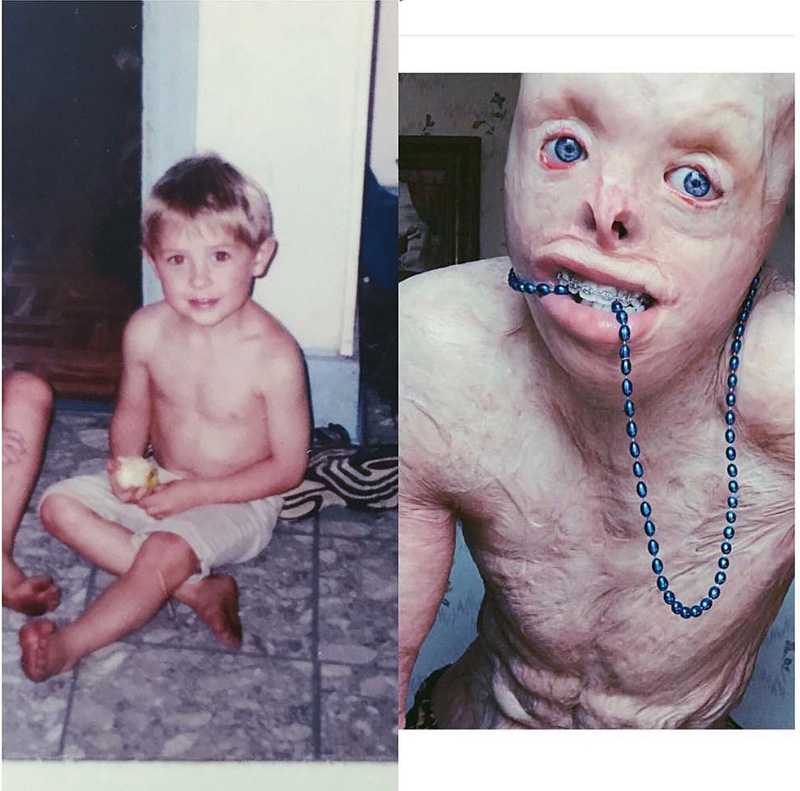 เหยื่อถูกไฟคลอก คอสเพลย์ เหยื่อถูกไฟคลอก คอสเพลย์