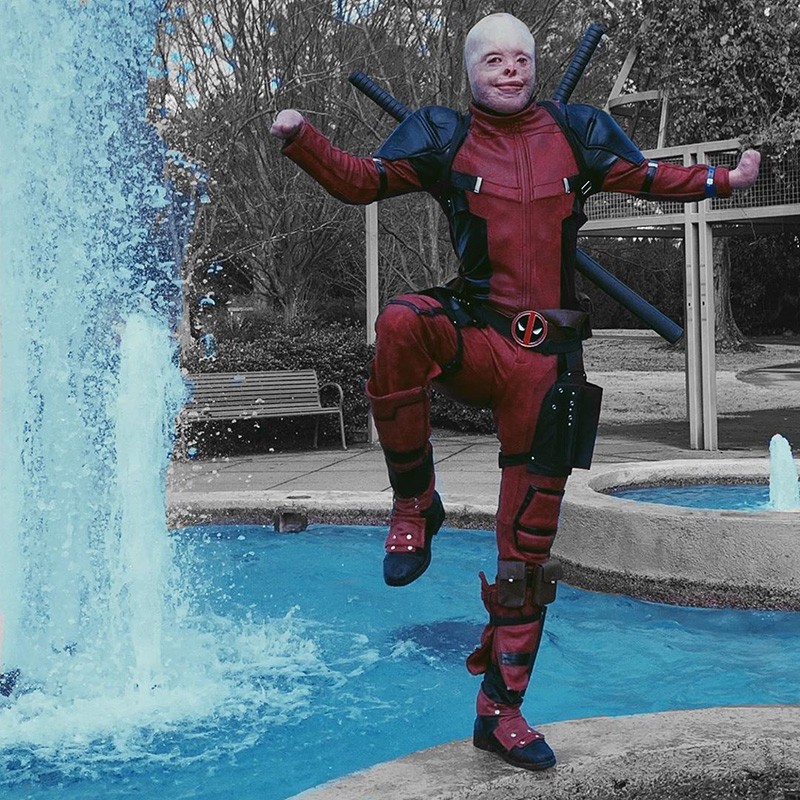 เหยื่อถูกไฟคลอก คอสเพลย์ เหยื่อถูกไฟคลอก คอสเพลย์