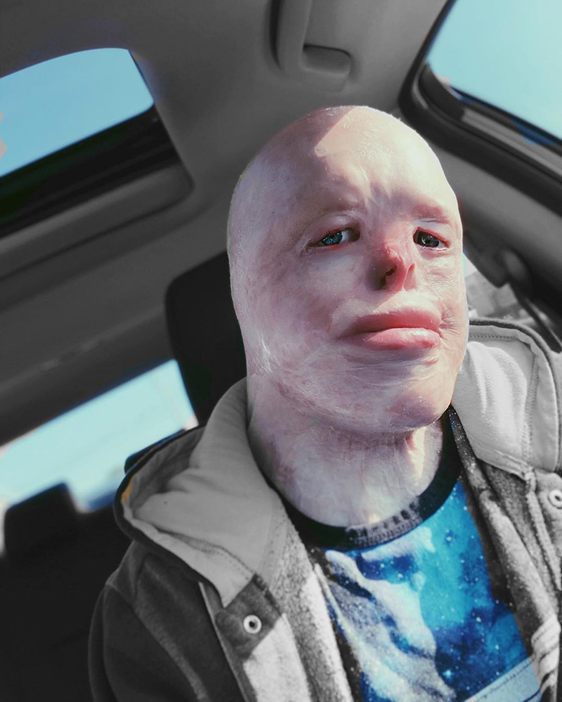 เหยื่อถูกไฟคลอก คอสเพลย์ เหยื่อถูกไฟคลอก คอสเพลย์