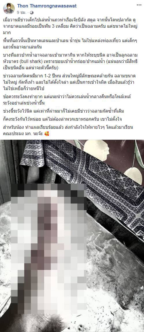 ฉลามกัดเท้า ฉลามกัดเท้า