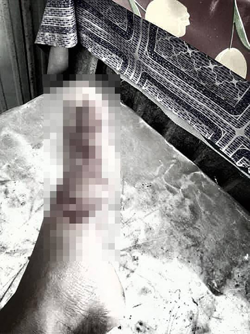 ฉลามกัดเท้า ฉลามกัดเท้า