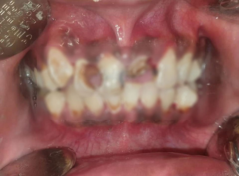 สาวจัดฟันแฟชั่น สาวจัดฟันแฟชั่น