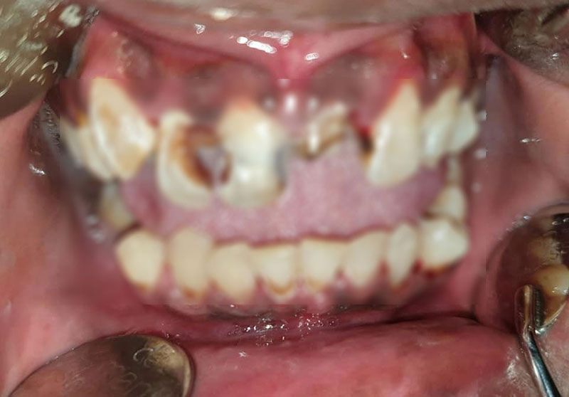 สาวจัดฟันแฟชั่น สาวจัดฟันแฟชั่น