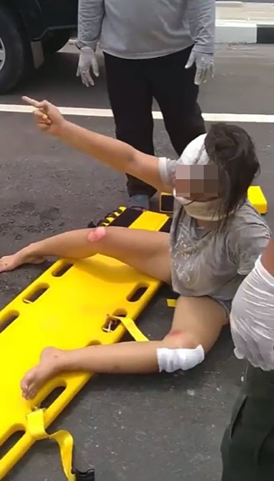 หญิงรถล้มเจ็บ หญิงรถล้มเจ็บ