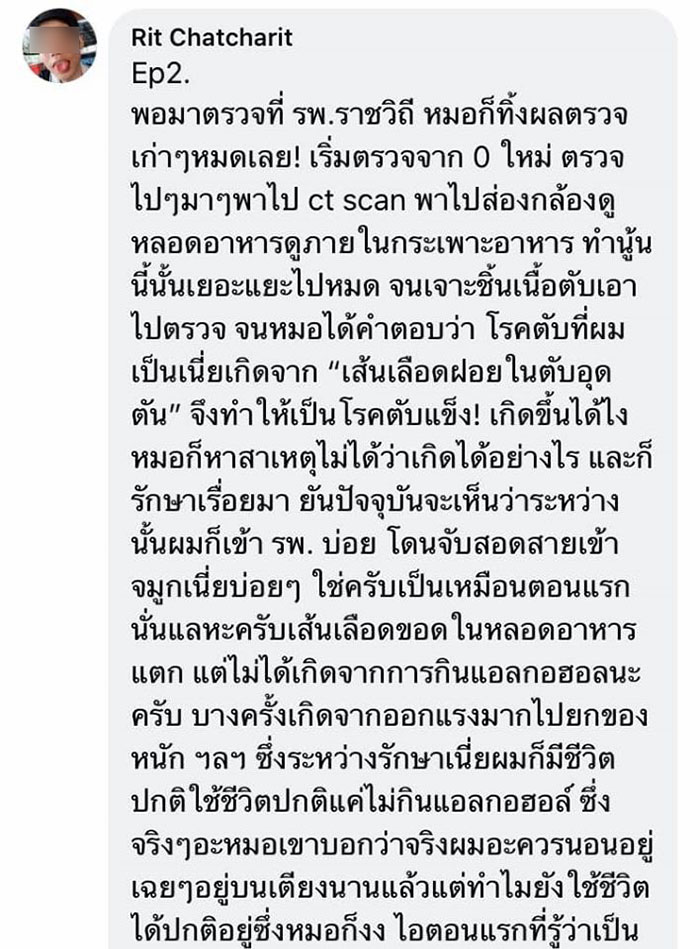 โรคตับแข็ง โรคตับแข็ง
