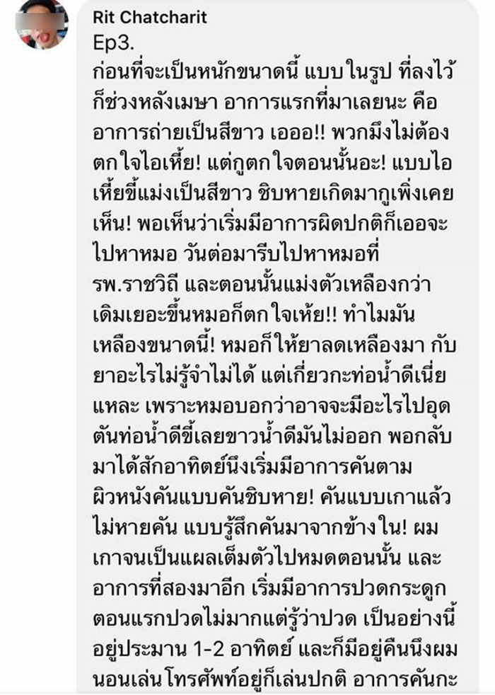 โรคตับแข็ง โรคตับแข็ง