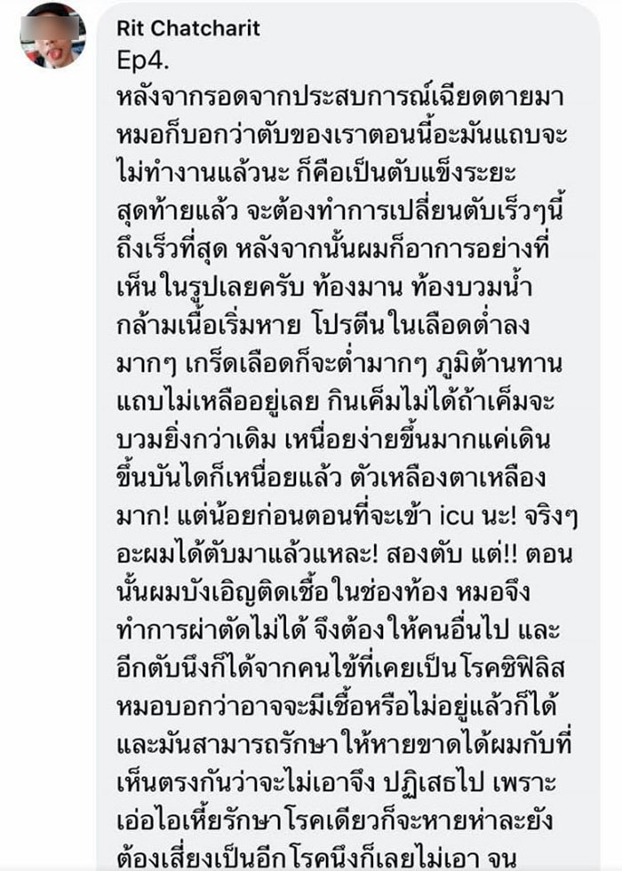 โรคตับแข็ง โรคตับแข็ง