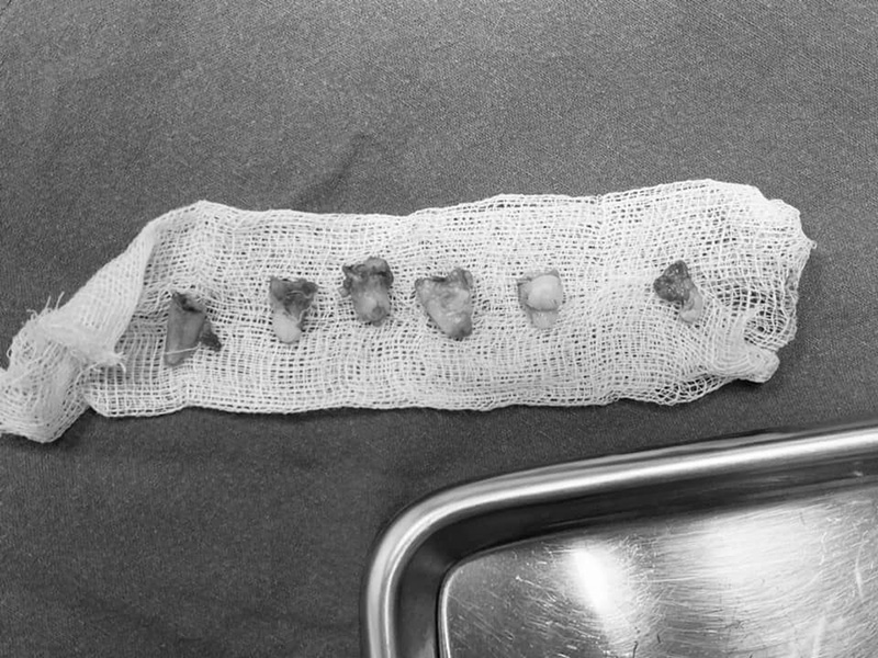 ดัดฟันแฟชั่น ดัดฟันแฟชั่น