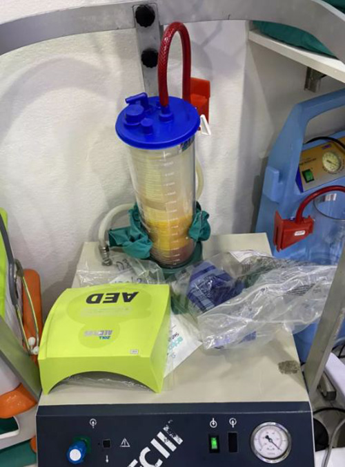 ดูดไขมัน ดูดไขมัน