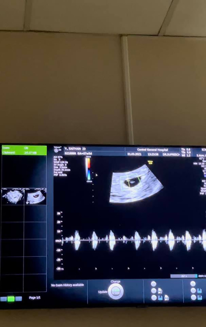 น้องเนย น้องเนย