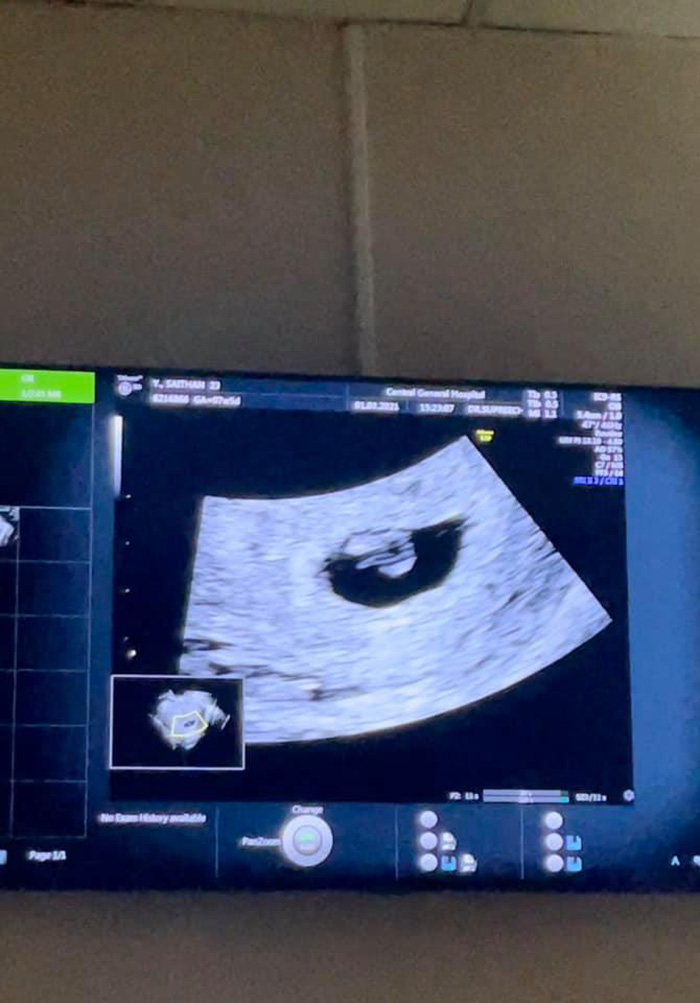 น้องเนย น้องเนย