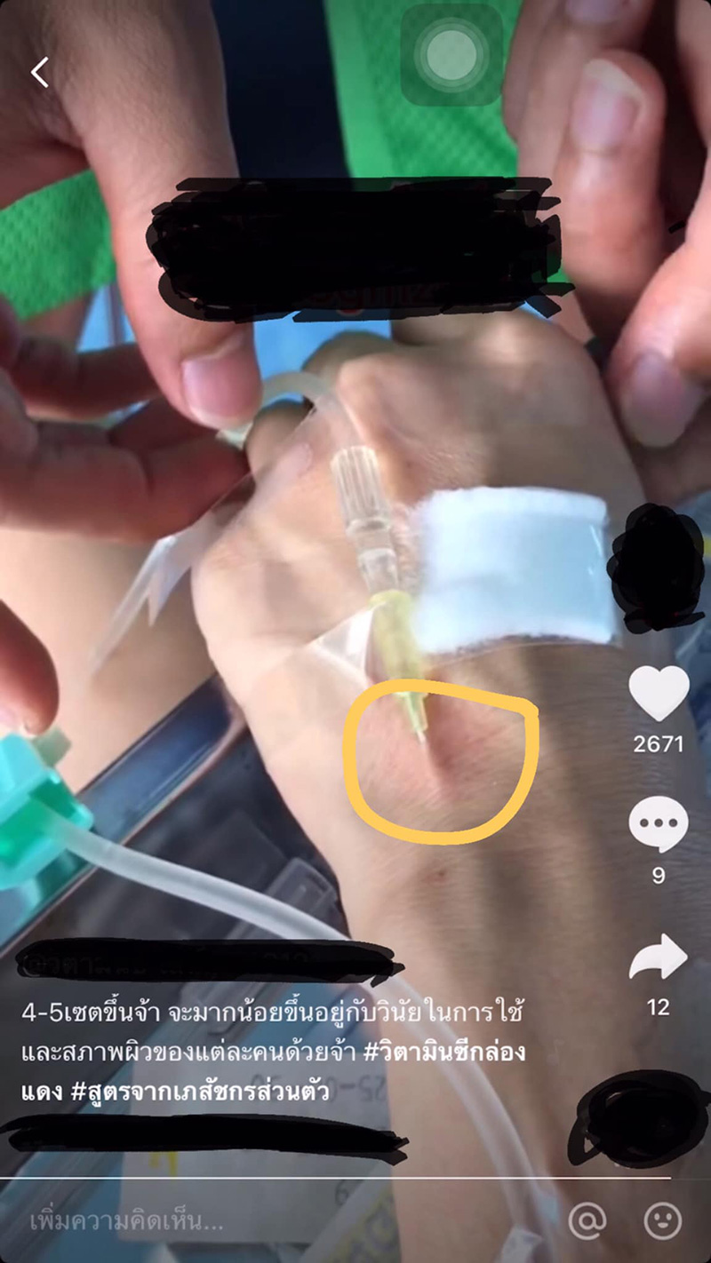 ฉีด วิตามินผิวขาว ฉีด วิตามินผิวขาว