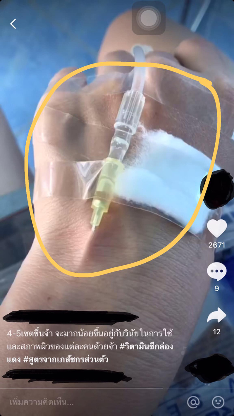 ฉีด วิตามินผิวขาว ฉีด วิตามินผิวขาว