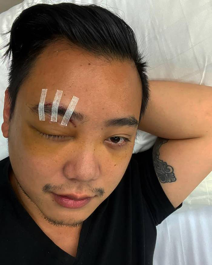 ไฮโซลูกนัท ไฮโซลูกนัท