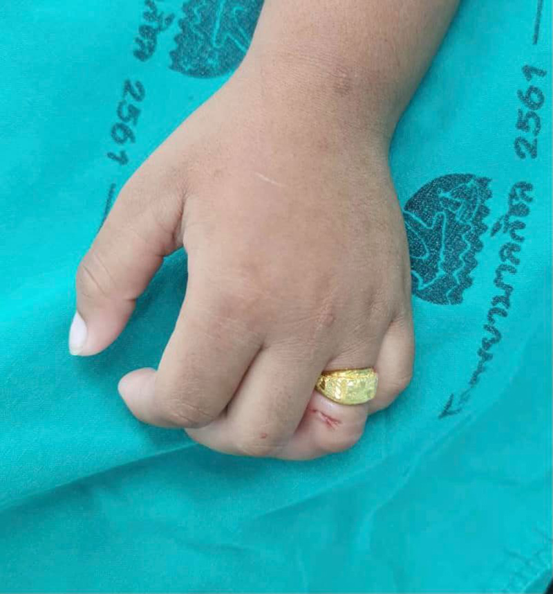 แหวนทองติดนิ้วเด็ก 3 ขวบ แหวนทองติดนิ้วเด็ก 3 ขวบ