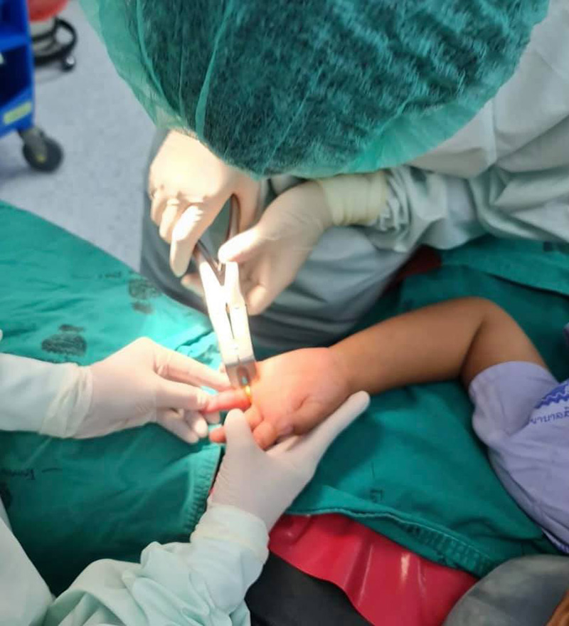 แหวนทองติดนิ้วเด็ก 3 ขวบ แหวนทองติดนิ้วเด็ก 3 ขวบ