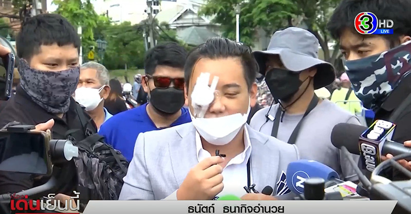 ไฮโซลูกนัท ไฮโซลูกนัท