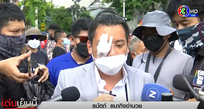 ไฮโซลูกนัท ไฮโซลูกนัท