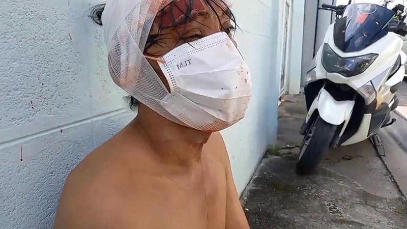 เมียเดือด ผัวทำกิ่งต้นไม้หัก คว้ามีดฟันเลือดอาบ เมียเดือด ผัวทำกิ่งต้นไม้หัก คว้ามีดฟันเลือดอาบ