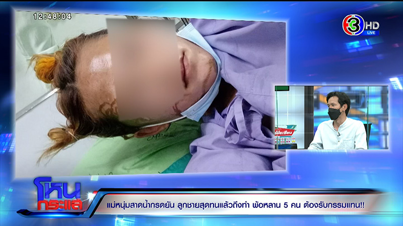 เหยื่อถูกสาดน้ำกรด ลูก 5 พูดแบบนี้ในโหนกระแส เหยื่อถูกสาดน้ำกรด ลูก 5 พูดแบบนี้ในโหนกระแส