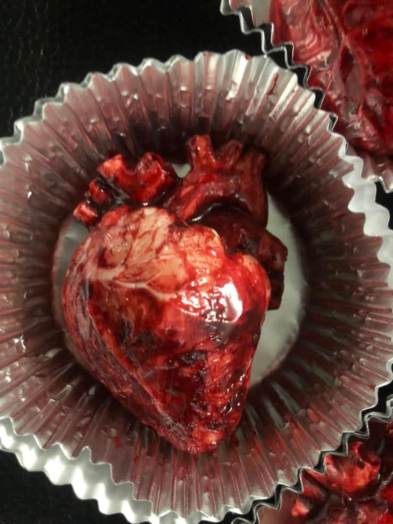 วาเลนไทน์สยอง เค้กหัวใจแบบหัวใจคนจริง ๆ วาเลนไทน์สยอง เค้กหัวใจแบบหัวใจคนจริง ๆ