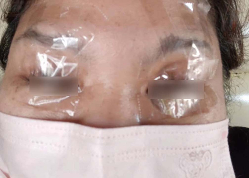 อุทาหรณ์สาว ๆ ต่อขนตา อุทาหรณ์สาว ๆ ต่อขนตา