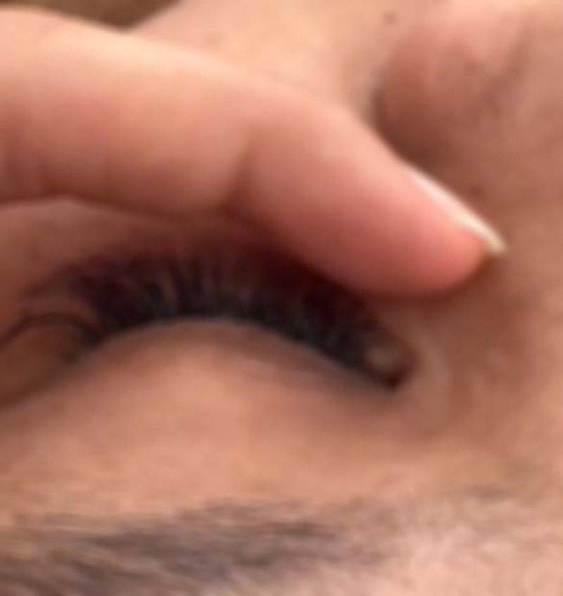 อุทาหรณ์สาว ๆ ต่อขนตา อุทาหรณ์สาว ๆ ต่อขนตา