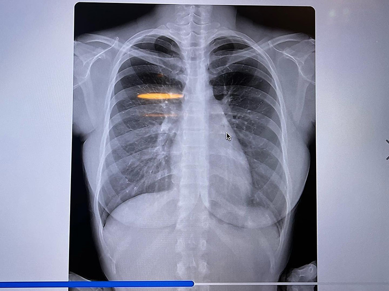 นางแบบสาวฮอต เปิดภาพเอกซเรย์ นางแบบสาวฮอต เปิดภาพเอกซเรย์