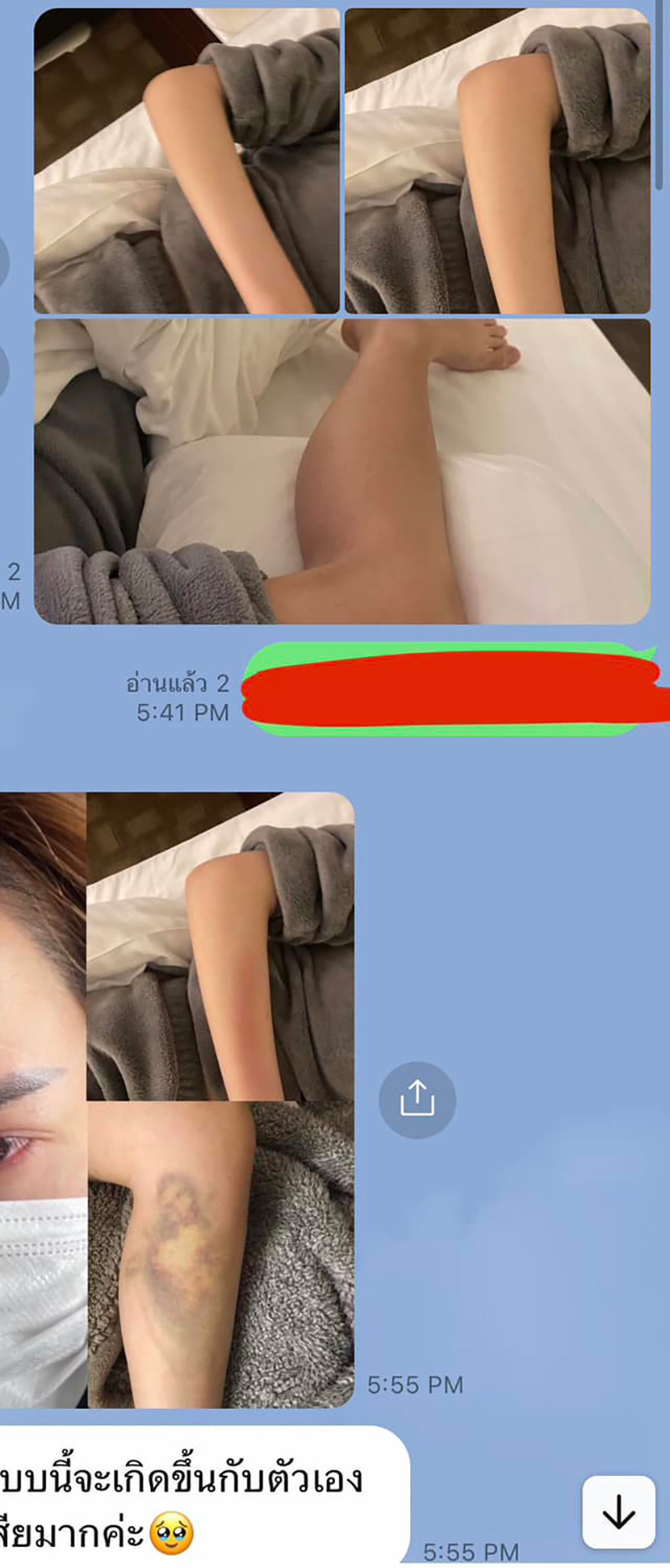 บาสตี้ ดราม่าภาคต่อ โป๊ะแตกขาช้ำจากอิแทวอน บาสตี้ ดราม่าภาคต่อ โป๊ะแตกขาช้ำจากอิแทวอน