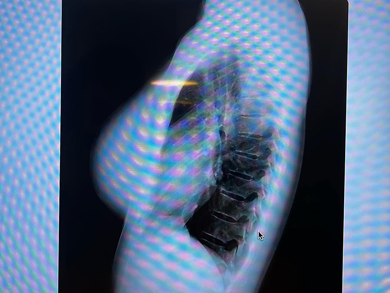 นางแบบสาวฮอต เปิดภาพเอกซเรย์ นางแบบสาวฮอต เปิดภาพเอกซเรย์