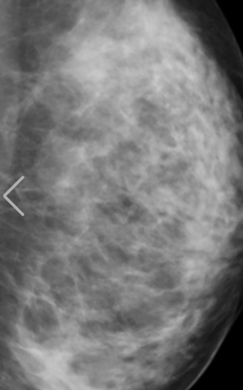 นางแบบสาวฮอต เปิดภาพเอกซเรย์ นางแบบสาวฮอต เปิดภาพเอกซเรย์