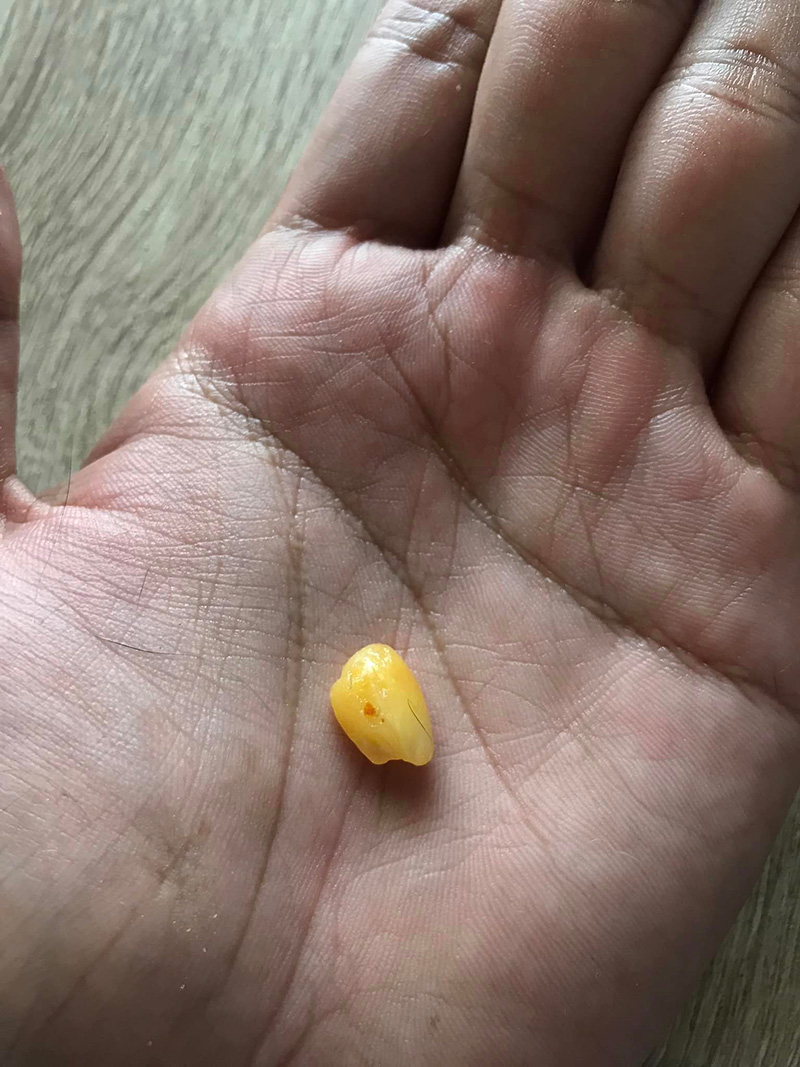 หนุ่มมักแจ่วบอง กินจนคำสุดท้าย เคี้ยวเจอสิ่งปริศนา หนุ่มมักแจ่วบอง กินจนคำสุดท้าย เคี้ยวเจอสิ่งปริศนา