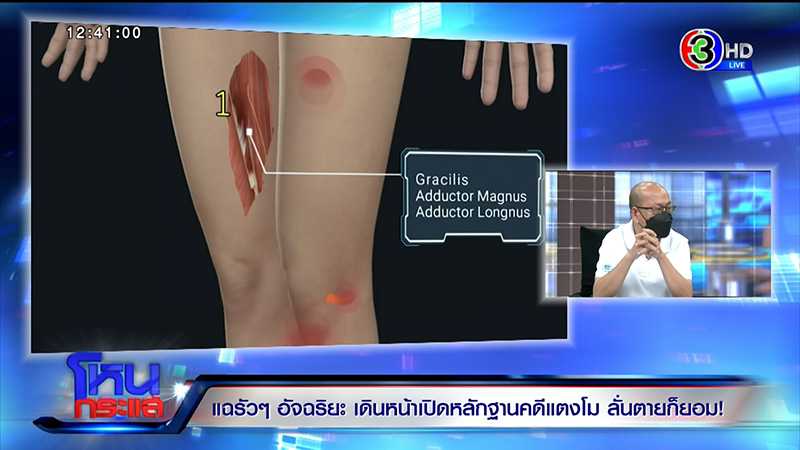 อัจฉริยะ แฉที่มาแผลเพิ่มที่ขา แตงโม ฟาดปากด่า ทนายเดชา อัจฉริยะ แฉที่มาแผลเพิ่มที่ขา แตงโม ฟาดปากด่า ทนายเดชา