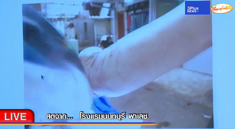 อัจฉริยะ แฉคลิป จนท. แอบนำศพ แตงโม เทียบใบพัดเรือ อัจฉริยะ แฉคลิป จนท. แอบนำศพ แตงโม เทียบใบพัดเรือ