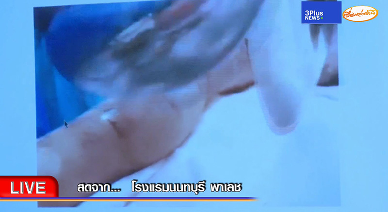 อัจฉริยะ แฉคลิป จนท. แอบนำศพ แตงโม เทียบใบพัดเรือ อัจฉริยะ แฉคลิป จนท. แอบนำศพ แตงโม เทียบใบพัดเรือ