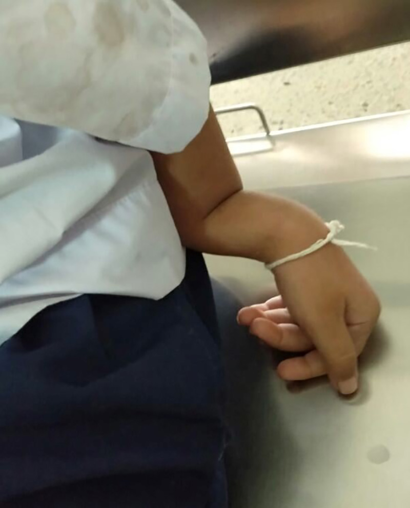 เด็ก 5 ขวบ แขนหัก ครูไม่พาไป รพ. เด็ก 5 ขวบ แขนหัก ครูไม่พาไป รพ.