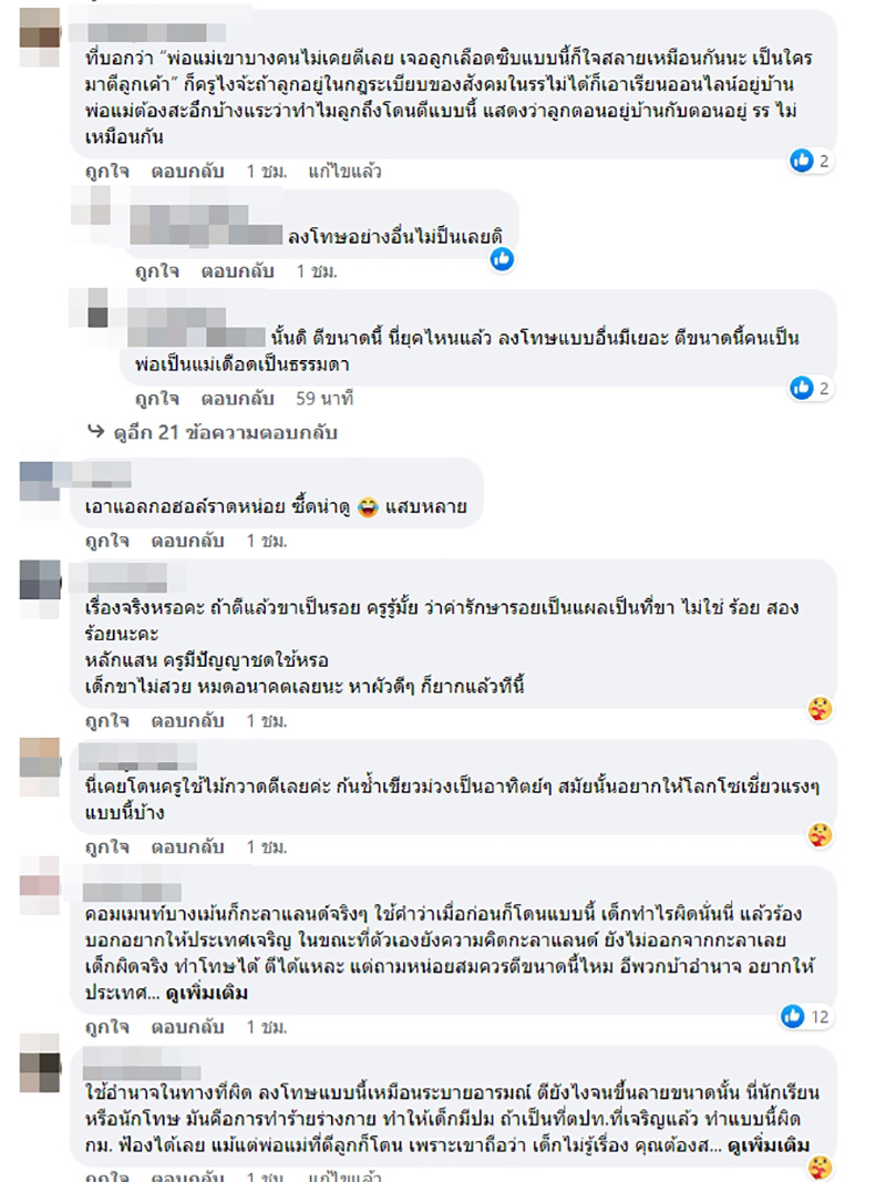 แม่เดือด เปิดภาพขาลูกหลังถูกครูตี แม่เดือด เปิดภาพขาลูกหลังถูกครูตี